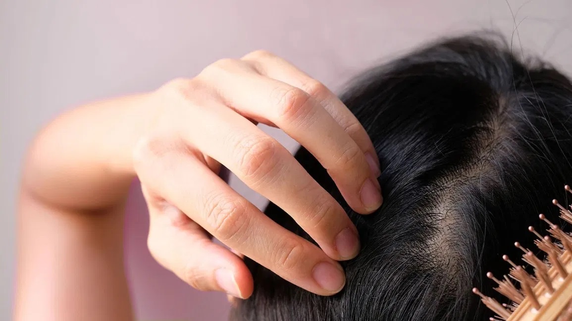 Hair Loss Treatment: Get Your Hair Back on Track!
